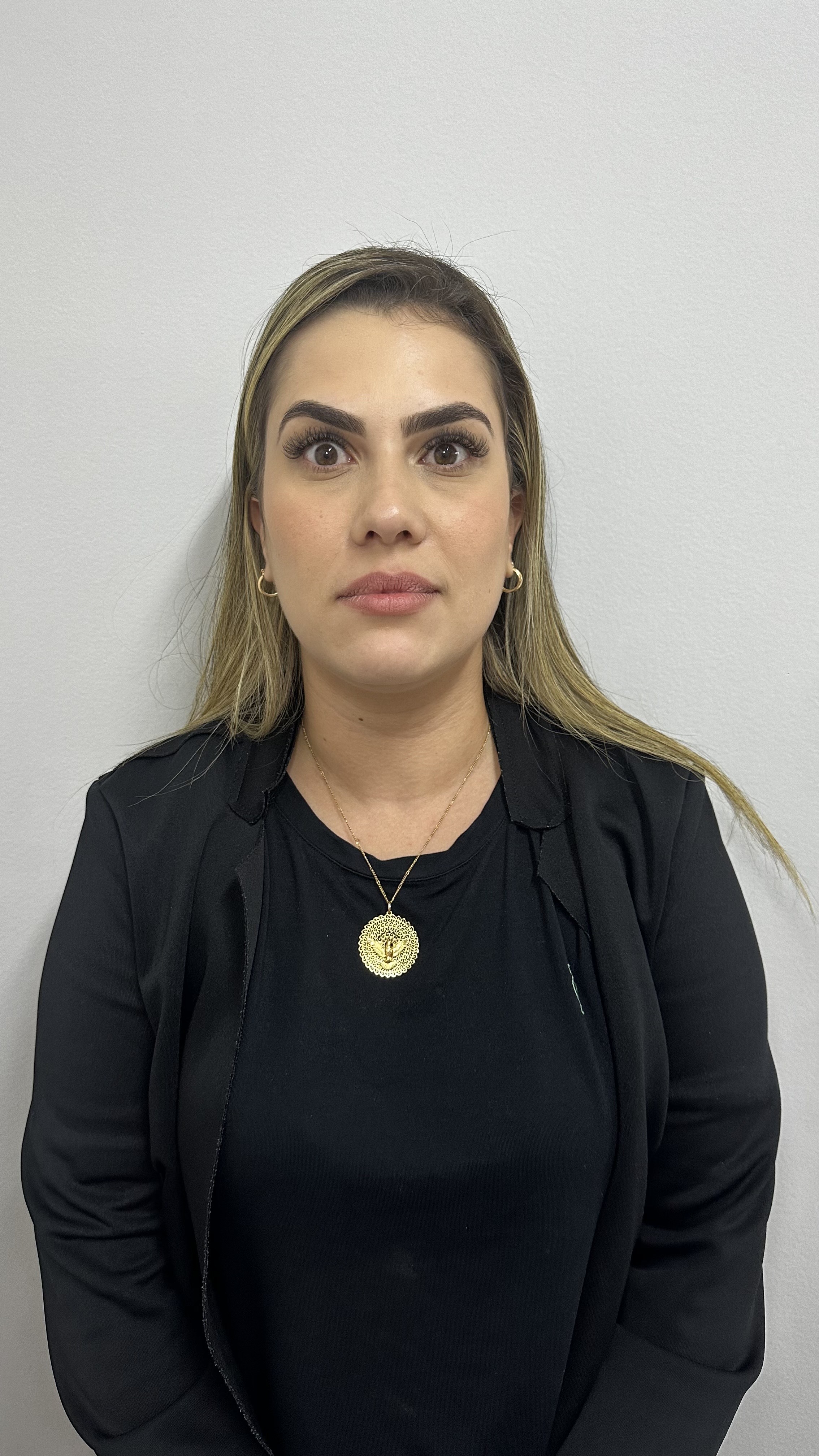 Depois - Toxina Botulínica