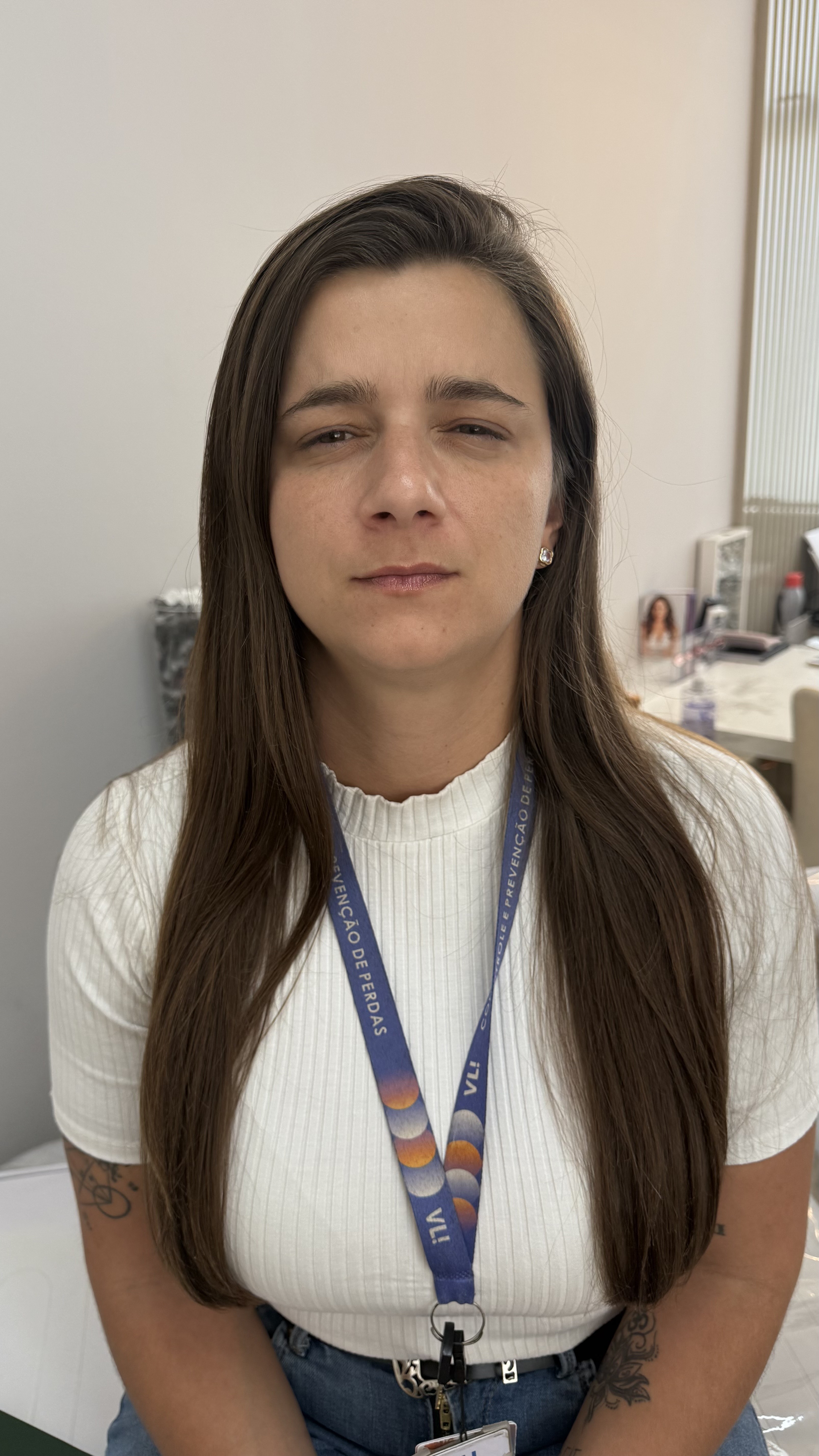 Depois - Toxina Botulínica