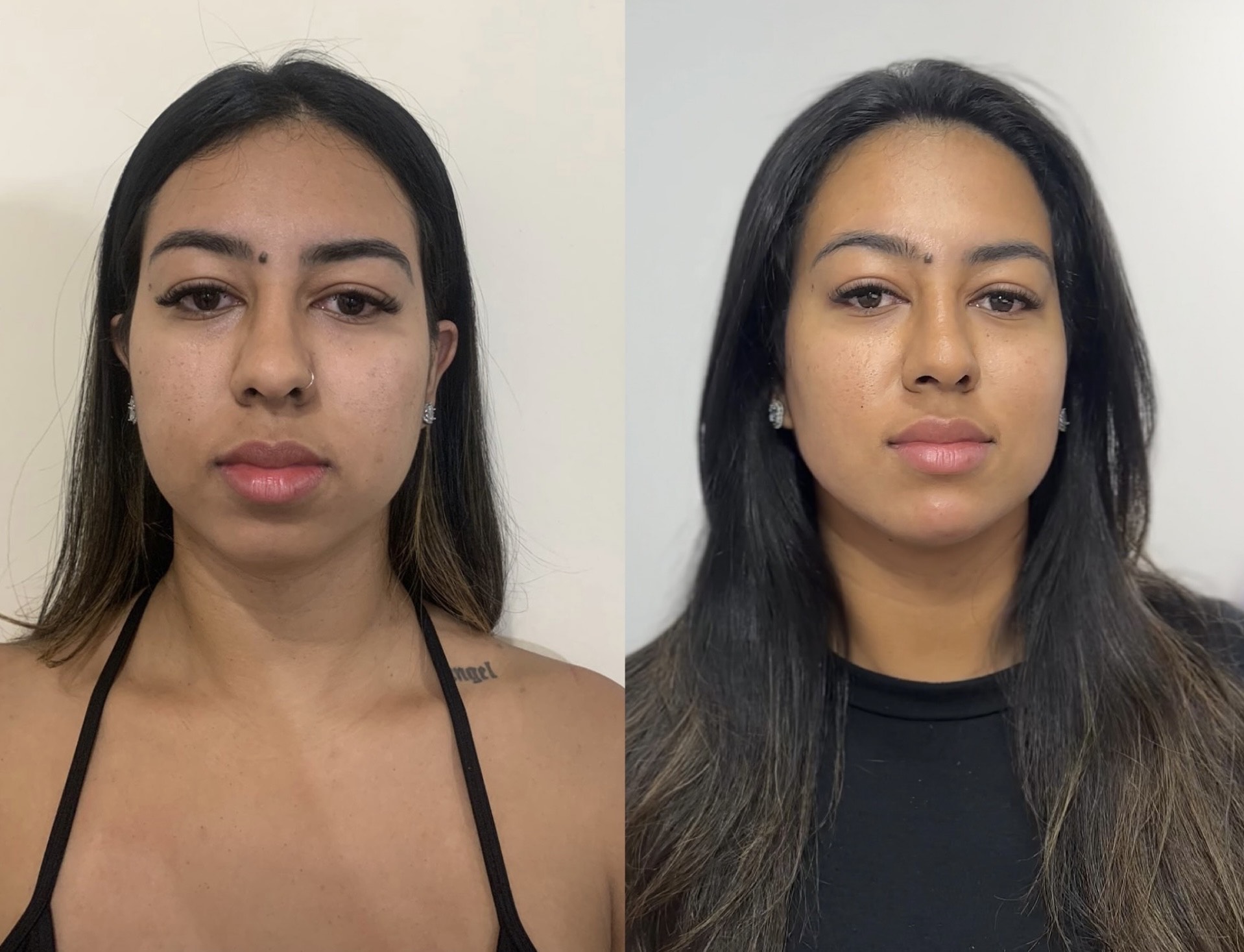 Resultado de Contorno facial