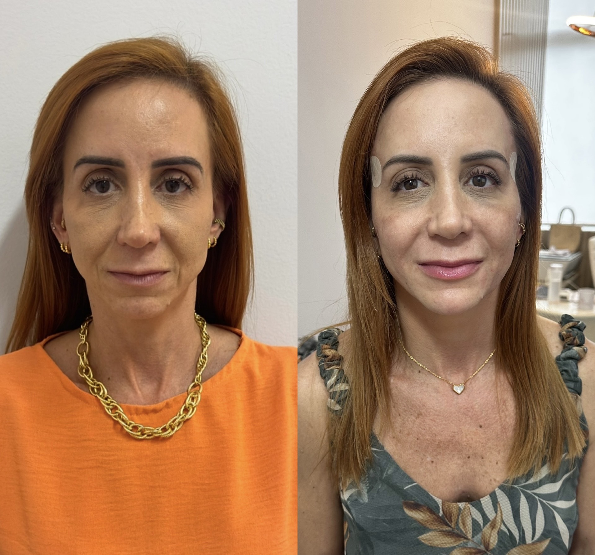 Resultado de Fio de PDO