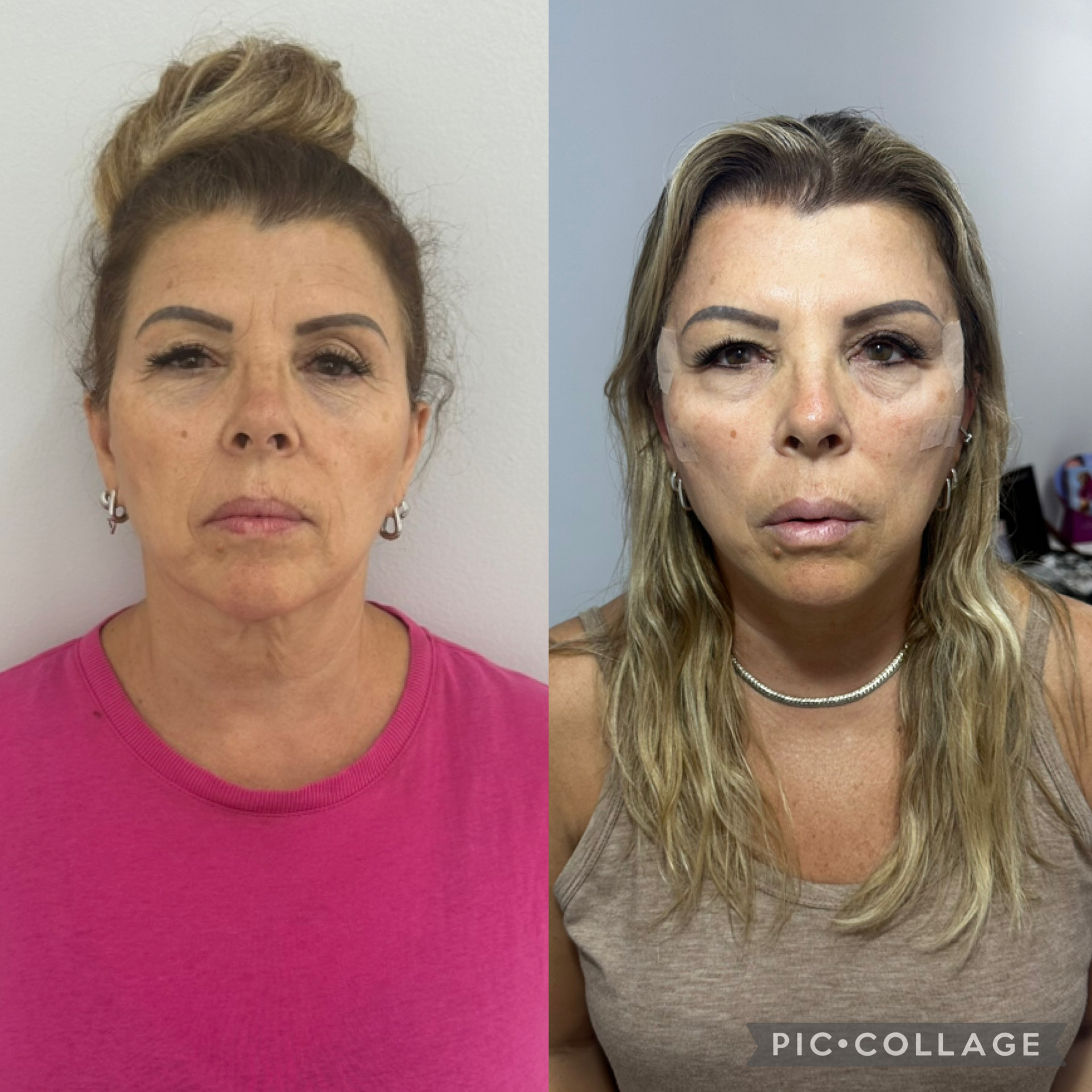 Resultado de Fio de PDO