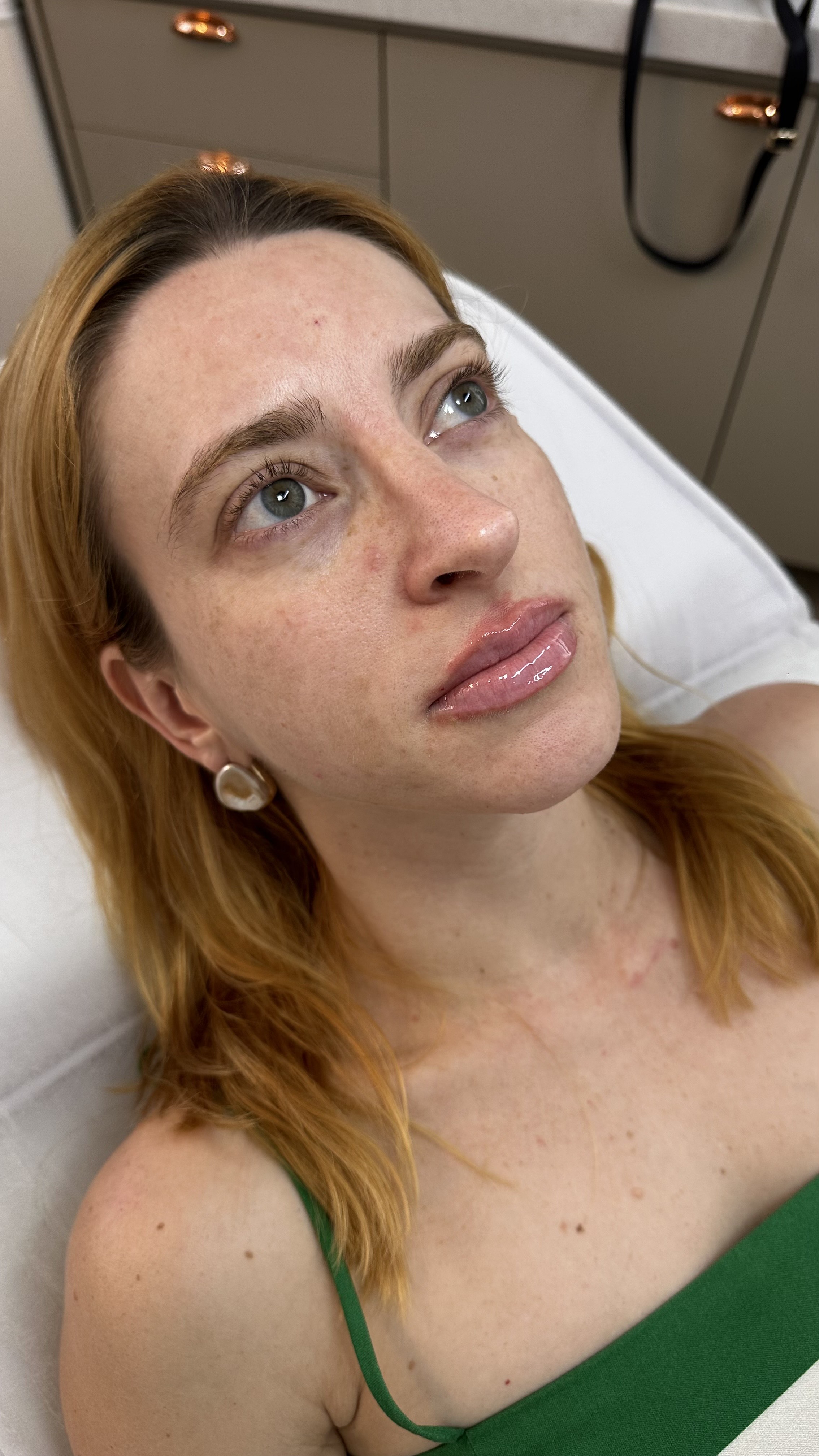 Resultado de Lábios